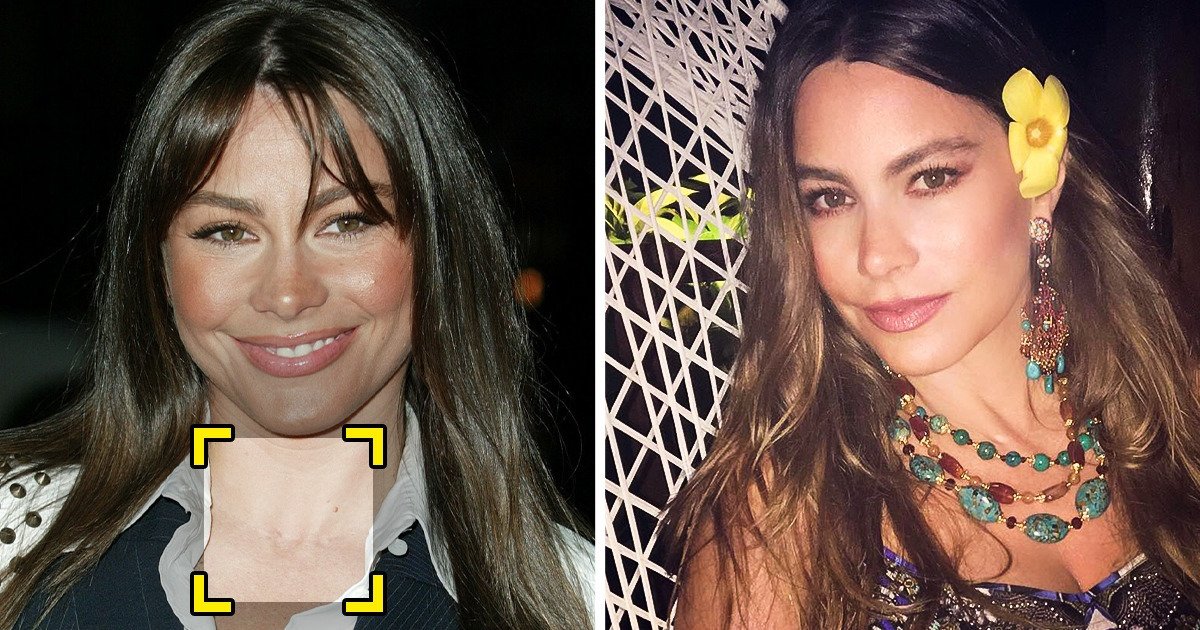 “This day, I Can Name Myself a Most cancers Survivor,” Sofia Vergara Won the Fight and Now Helps Others
