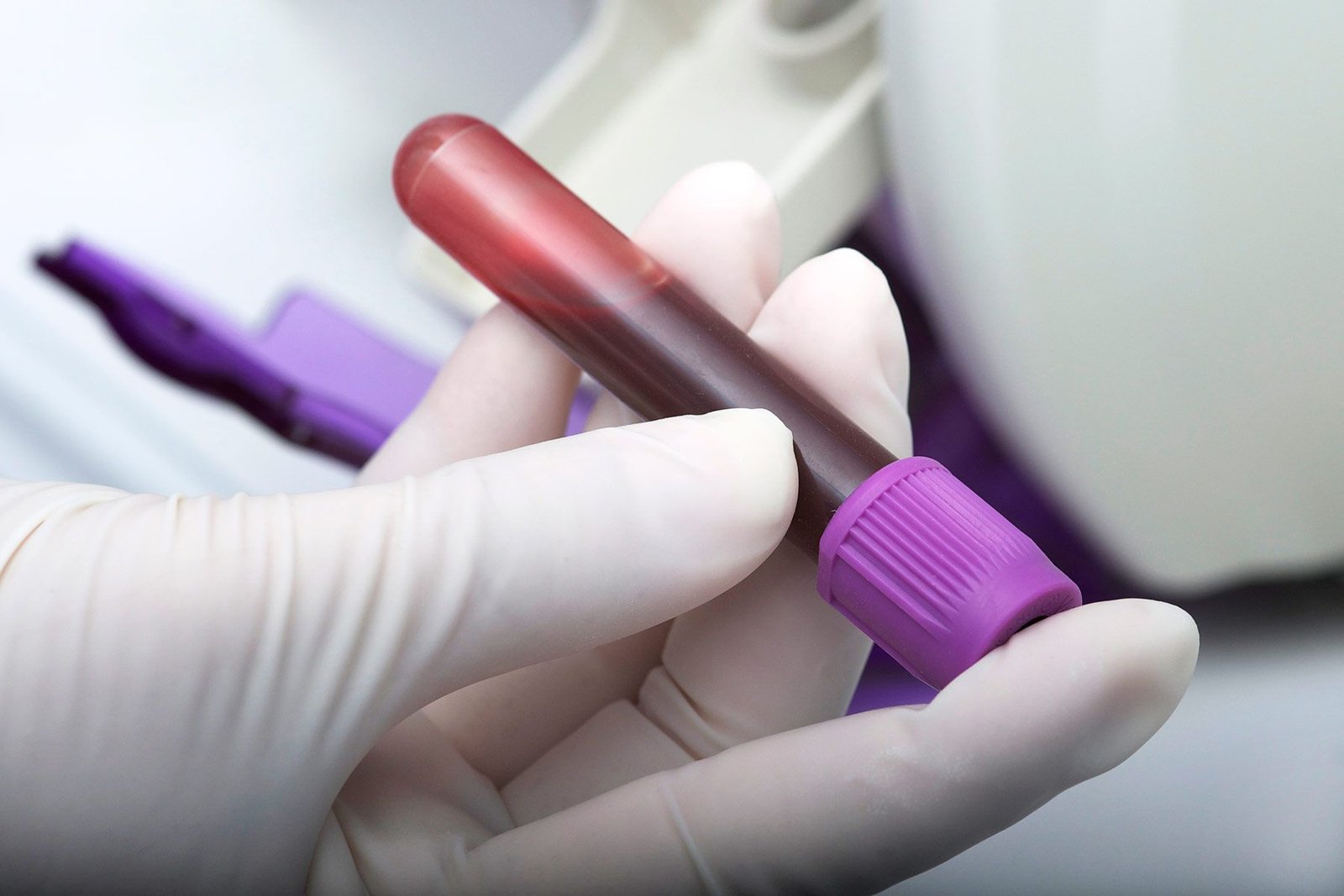 Blood Check for Most cancers Now Readily available, But Is It Ready for Top Time?