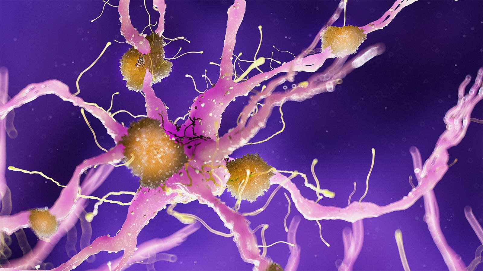 Donanemab Analyses Point out Advantages for Take Alzheimer’s Sufferers